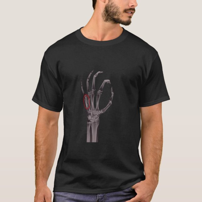  Broken Bones Hands Skeleton X-RAY T-Shirt (Front)