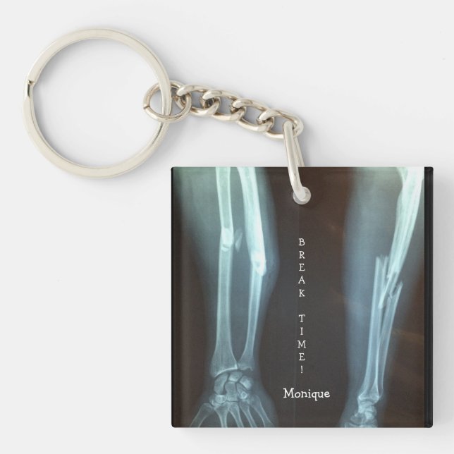 Broken Radius and Ulna Xray "Break Time"   Key Ring (Front)