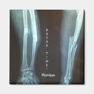 Broken Radius and Ulna Xray "Break Time" Magnet