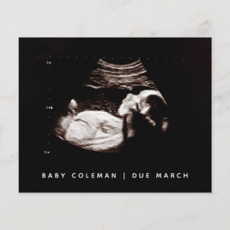 Budget Pregnancy Baby Sonogram Ultrasound Photo Flyer