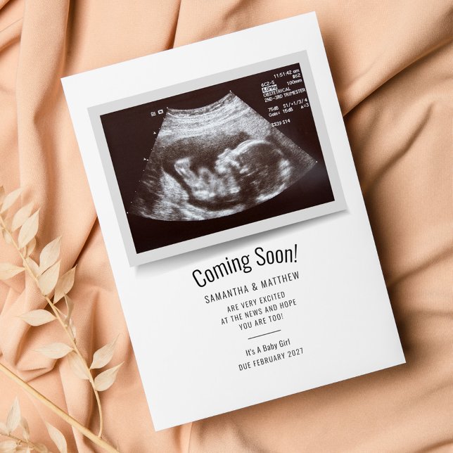 Budget Ultrasound Photo Pregnancy Announcement (Sonogram Pregnancy Announcement Baby Scan Photo Card)