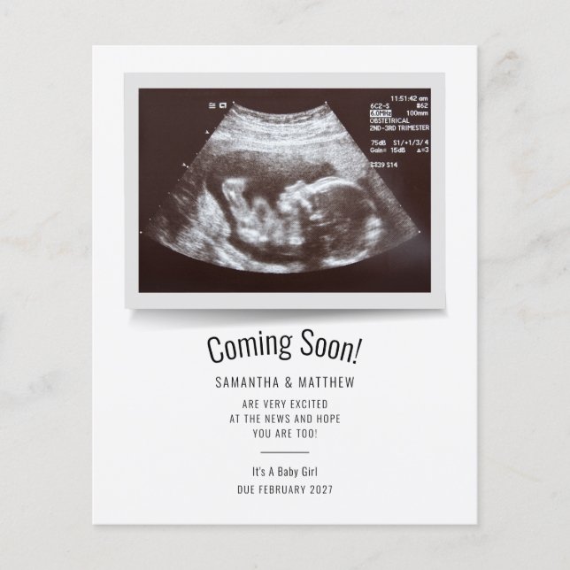 Budget Ultrasound Photo Pregnancy Announcement Flyer (Front)