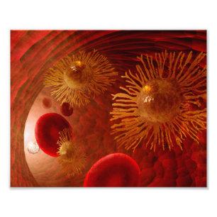 Cancer metastasis poster