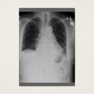 Cardiac Surgery ~ ATC