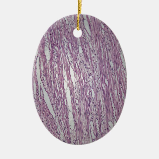 Cells of human uterus tissue with inoffensive tumo ceramic tree decoration (Front)