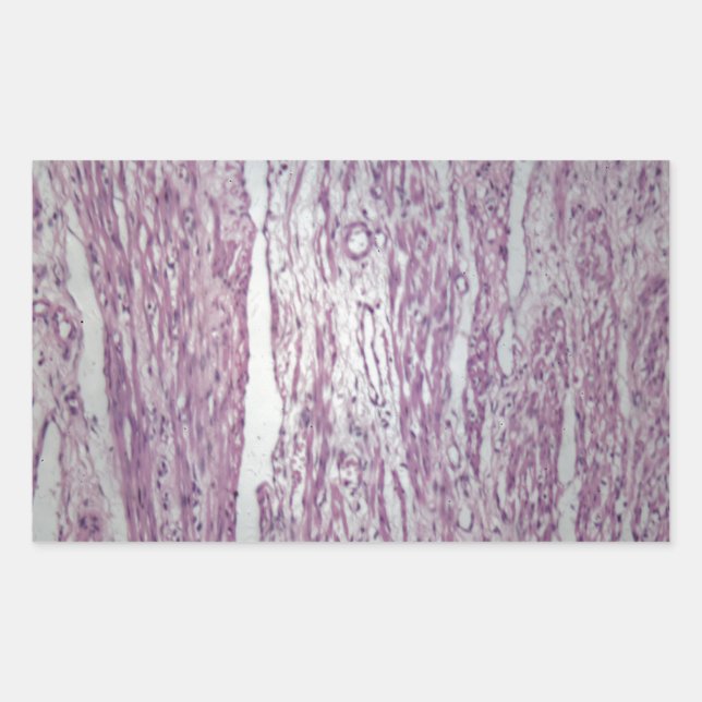 Cells of human uterus tissue with inoffensive tumo rectangular sticker (Front)