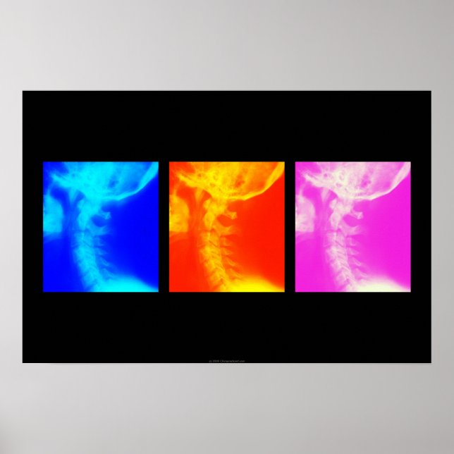 Cervical X-ray Chiropractic poster 1 (Front)