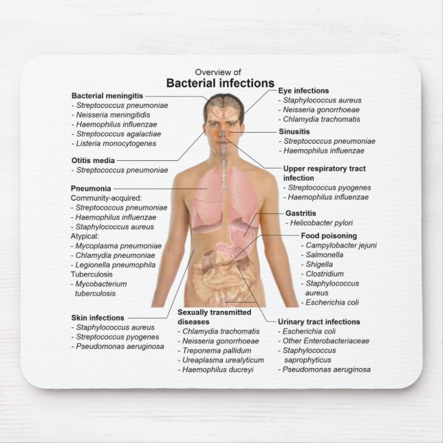 Chart of the bacterial infections in Humans  Mouse Pad (Front)