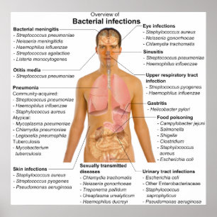 Chart of the Main Bacterial Infections in Humans