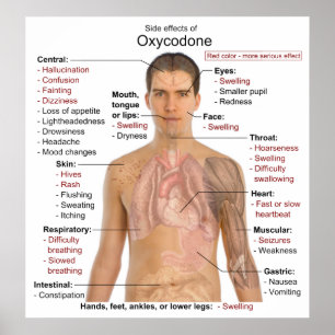 Chart of the Main Side Effects of Oxycodone