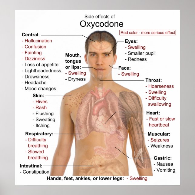 Chart of the Main Side Effects of Oxycodone (Front)