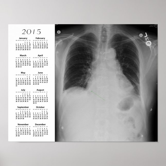Chest X Ray calendar ~ Poster (Front)
