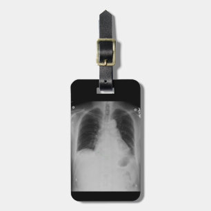 Chest X Ray ~ Luggage tag