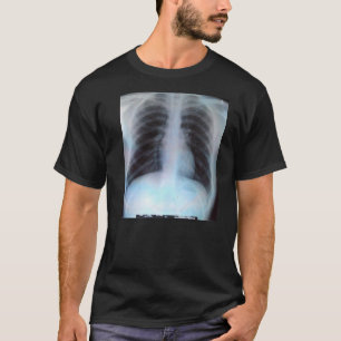 Chest X Ray T-Shirt