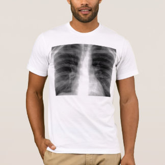 Chest X-ray T-Shirt