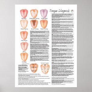 Chinese Tongue Diagnosis Acupuncture Poster