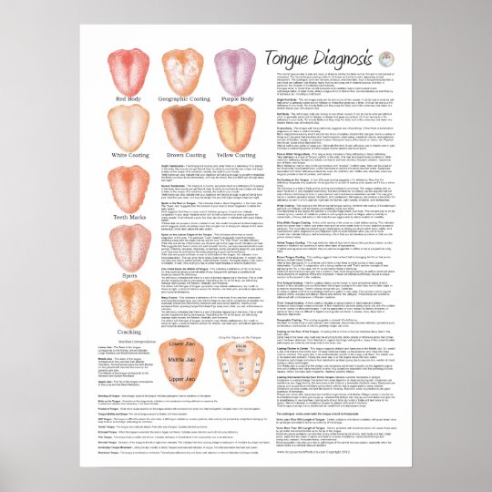Chinese Tongue Diagnosis Acupuncture Poster