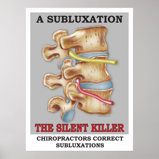 Chiropractic Subluxation Silent Killer Poster (Front)
