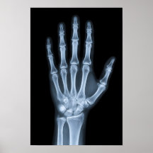 Clinical X-Ray Hand