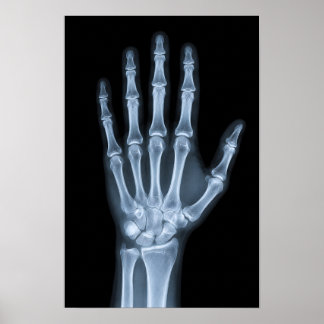 Clinical X-Ray Hand Poster