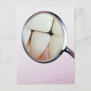 Close-up of teeth reflected in dental mirror postcard
