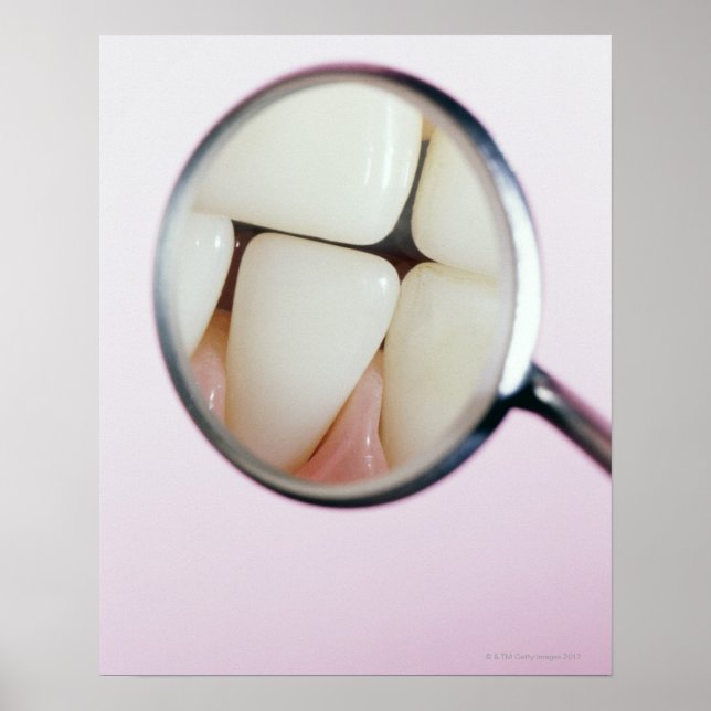 Close-up of teeth reflected in dental mirror poster (Front)