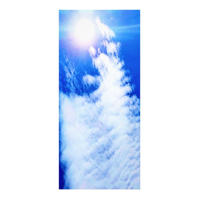 Clouds In Ottawa Sunny Skies. Buy Now Photo Print (Front)