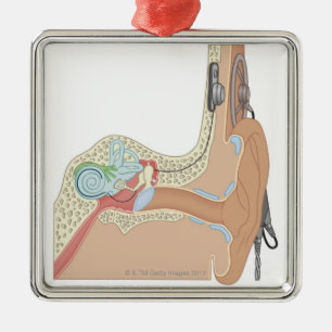 Cochlear Implants Metal Tree Decoration