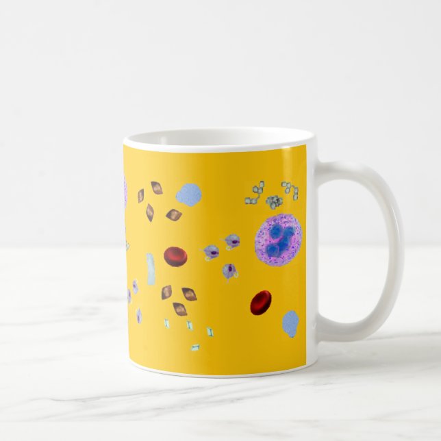 Coffee Mug-Urine Particulates (yellow background) Coffee Mug (Right)