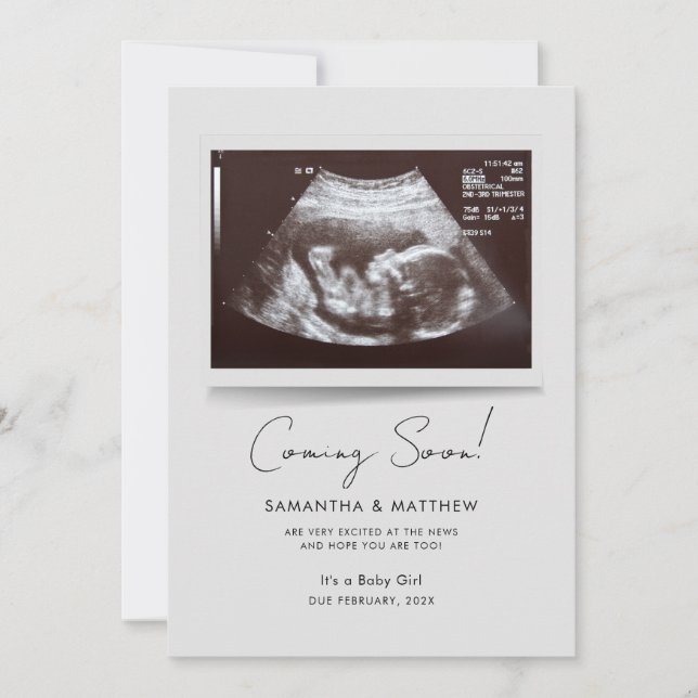 Coming Soon Photo Baby Scan Pregnancy Announcement (Front)