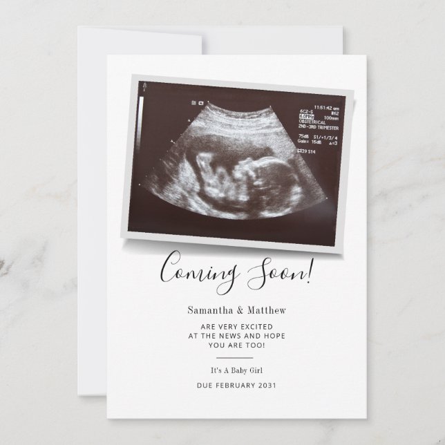 Coming Soon Script Ultrasound Sonogram Pregnancy Announcement (Front)