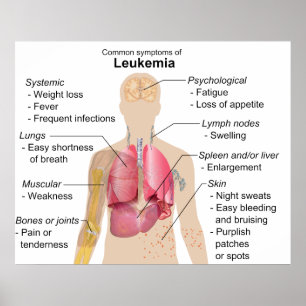 Common Symptoms Chart of Leukaemia Blood Cancer