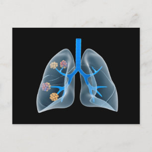 Conceptual Image Of Human Heart 4 Postcard