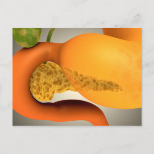 Conceptual Image Of Human Pancreas And Stomach Postcard