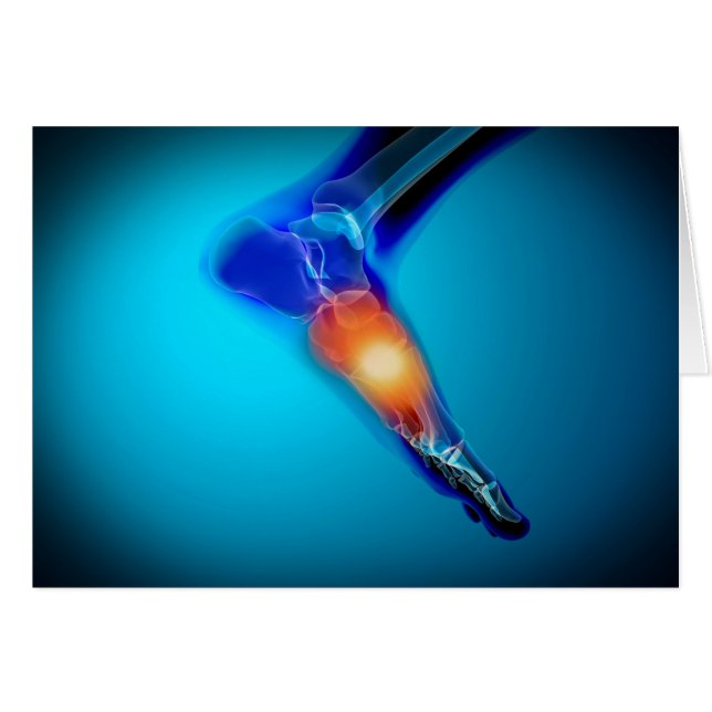 Conceptual Image Of Pain In Human Foot (Front Horizontal)