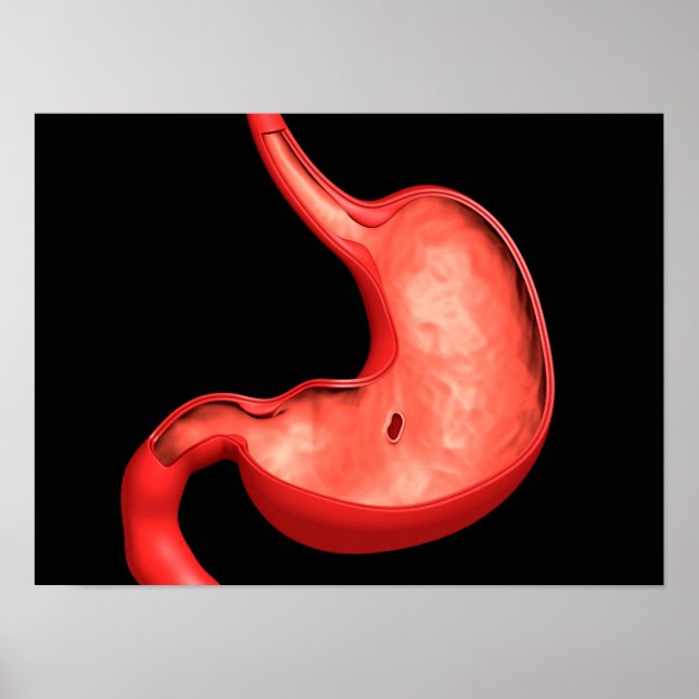 Conceptual Image Of Peptic Ulcer In Stomach Poster (Front)