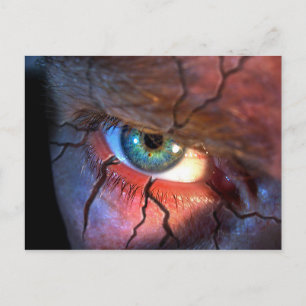 Cracked Eye Postcard