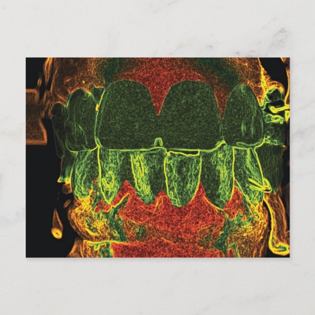 Crazy Teeth Model Design Dentist Orthodontist Card (Front)