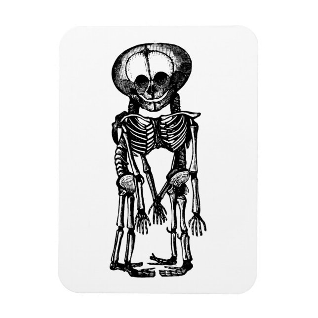 creepy siamese twins skeleton kids anatomy art magnet (Vertical)