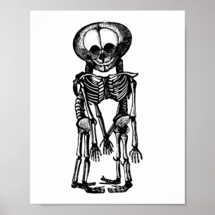 creepy siamese twins skeleton kids anatomy art poster