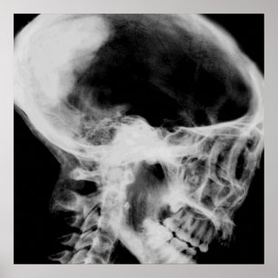 Creepy X-Ray Skull (Black & White) Poster