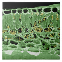 Cross Section of Leaf