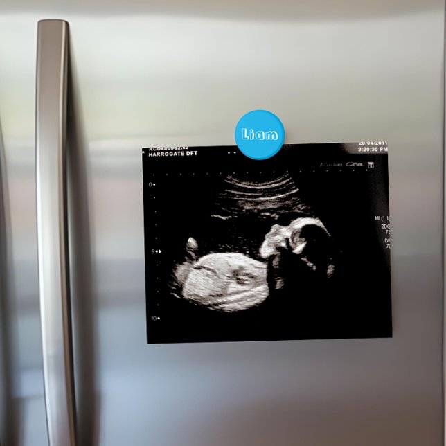 Custom Azure Blue Name Ultrasound Display Fridge Magnet (Creator Uploaded)