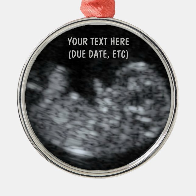 Custom Baby Ultrasound Photo Metal Ornament (Front)