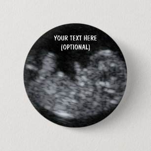 Custom Baby Ultrasound Picture 6 Cm Round Badge