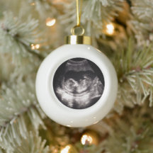 Custom Baby Ultrasound Pregnancy Announcment Photo