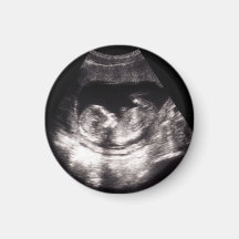 Custom Baby Ultrasound Pregnancy Announcment Photo