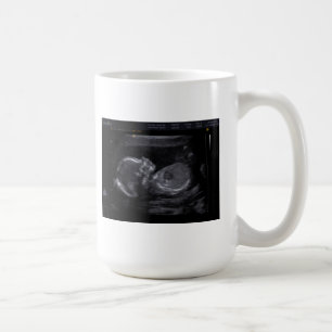 Customised Ultrasound Mug