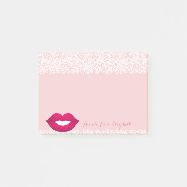 Cute Lovely  Stylish Girly,Lace, Lips Post-it Notes (Front)