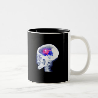 Cyborg Brain Two-Tone Coffee Mug
